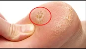 Screenshot_20220413_055312_com.huawei.hwsearch_edit_8654191230969.webp