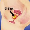 g-shot-nedir.jpg g-shot-nedir.jpg