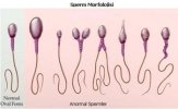 sperm-morfoloji.jpg sperm-morfoloji.jpg