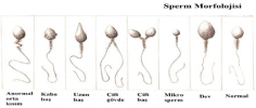 sperm.png sperm.png