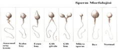 sperm.png