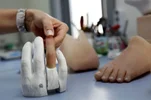 45886,ortez-protez-1jpg.webp 45886,ortez-protez-1jpg.webp