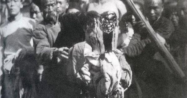 Sonrasında ise kesme işlemine, yine kanamanın çok olmayacağı kafa derisi ile devam edilir. Sonrasında ise kesme işlemine, yine kanamanın çok olmayacağı kafa derisi ile devam edilir.