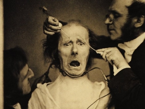 11. Fransız nörolog Duchenne de Boulogne'nin medikal çalışmaları sırasında çekilen fotoğraf: 11. Fransız nörolog Duchenne de Boulogne'nin medikal çalışmaları sırasında çekilen fotoğraf: