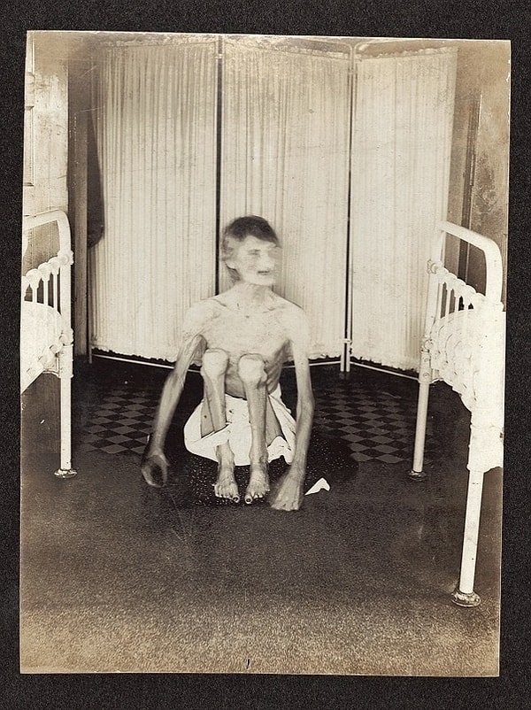 21. Ölü kadının fotoğrafı: 21. Ölü kadının fotoğrafı: